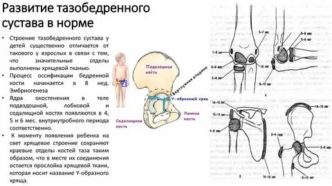 Воспаление тазобедренного сустава у ребенка