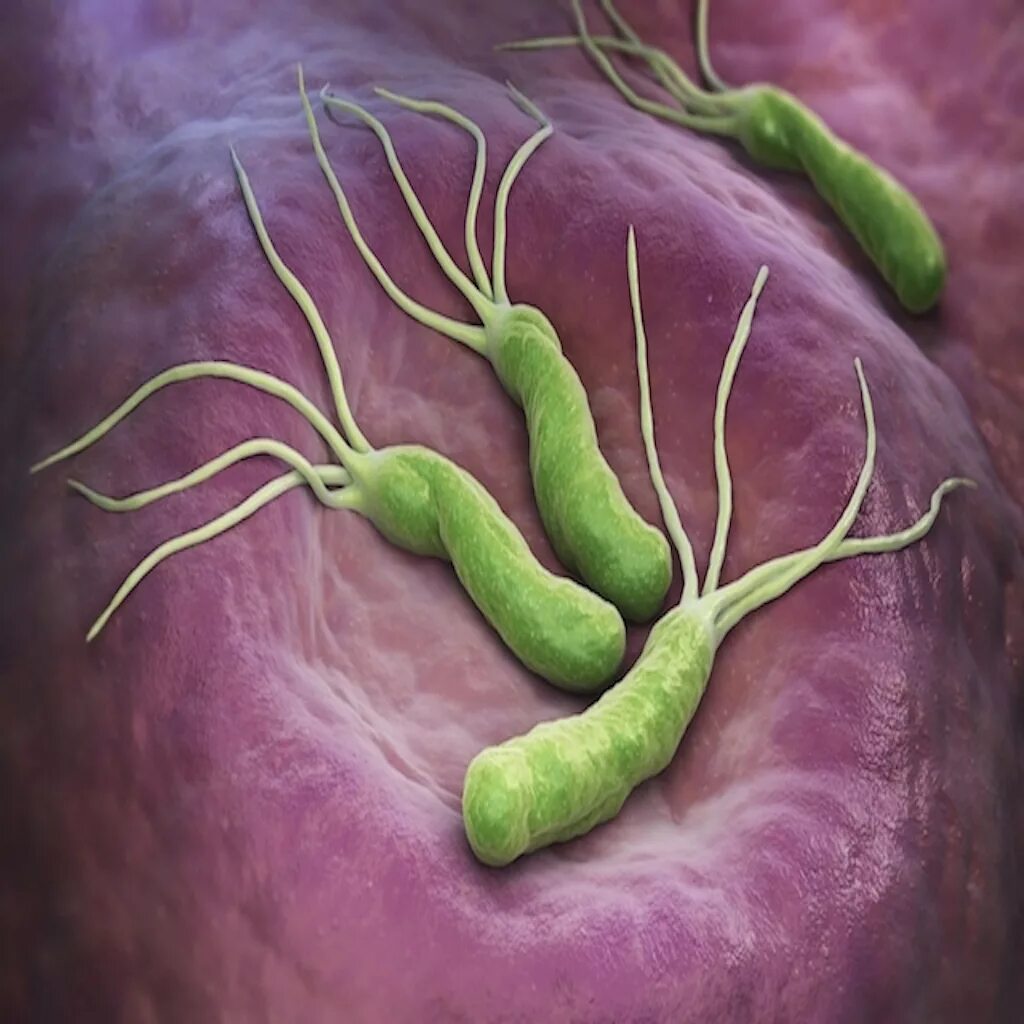 Гастрит бактерия Helicobacter pylori. Бактериальная инфекция хеликобактер пилори.