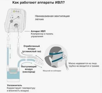 Сколько находится на ивл