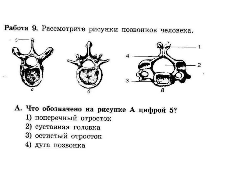 Лабораторная работа строение позвонков. Строение позвоночника рис 28. позвонок рисунок с обозначениями. рассмотрите рисунки позвонков человека. строение позвонка рис 19.
