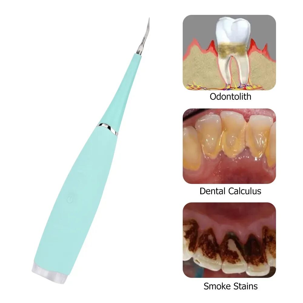 Как называется инструмент для чистки зубов ультразвуком. Электрический звуковой стоматологический скалер. Скалер для чистки зубного камня.