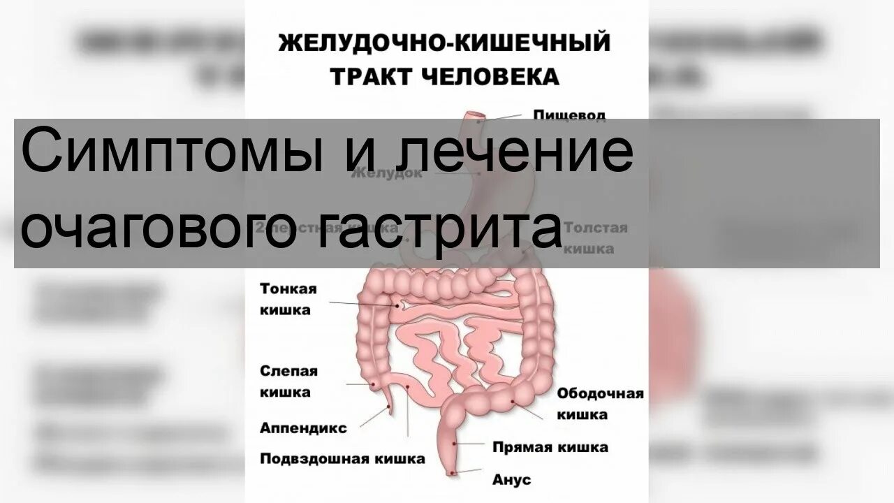 Спастическое сокращение кишечника. Спазм кишечника симптомы.