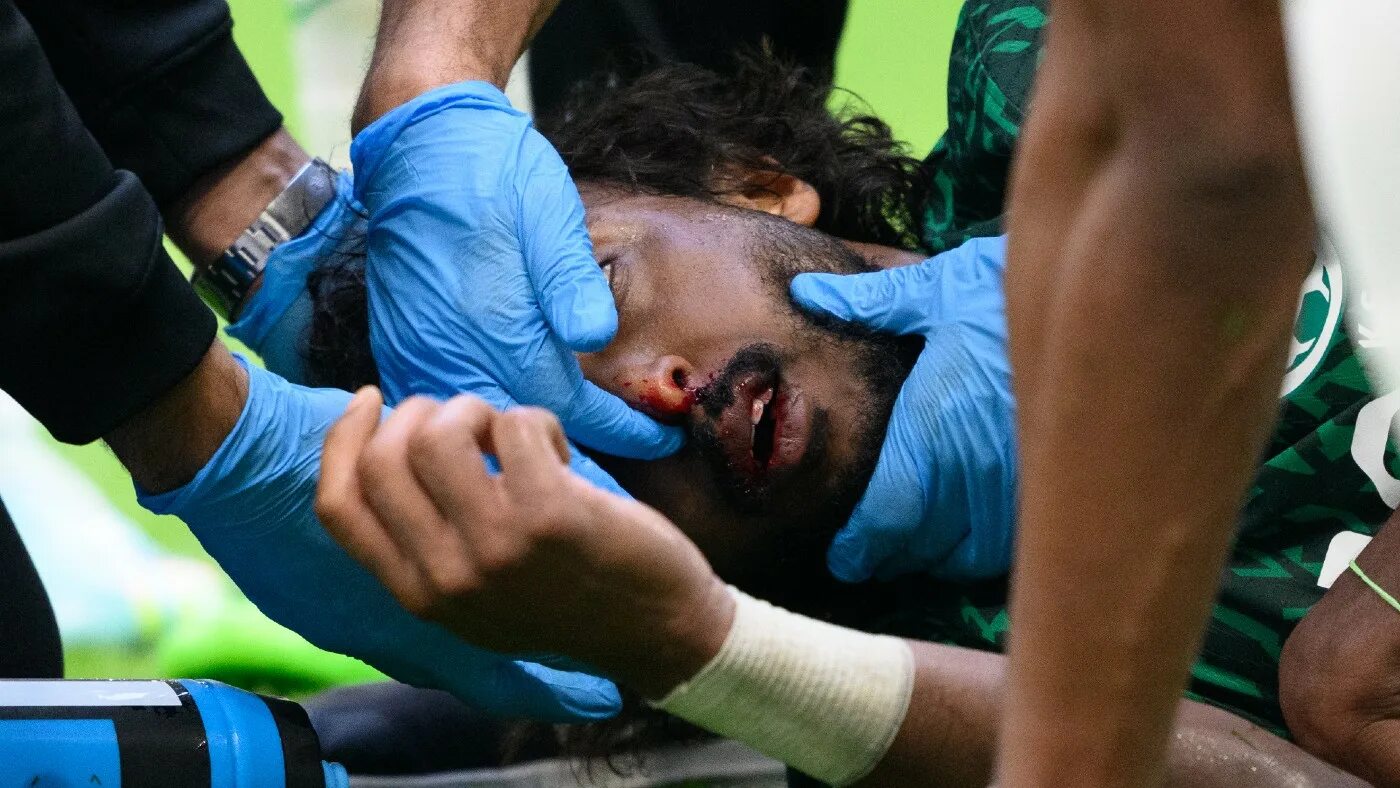 Ясир Аль Шахрани. Яссер Аль-Шахрани травма. Спортивные травмы. Травма ЧМ 2022 Саудовская Аравия.