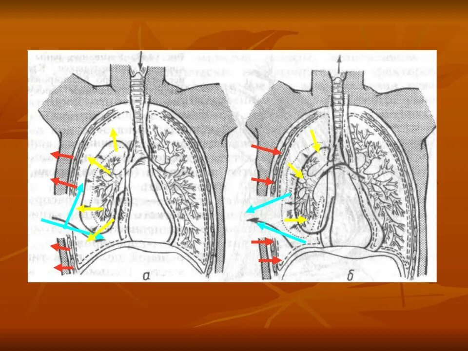 Механизм первого вдоха и выдоха. Движение воздуха при вдохе и выдохе. Движение воздуха при вдохе и выдохе. Легкие на вдохе и выдохе. Закрытый пневмоторакс движение воздуха.