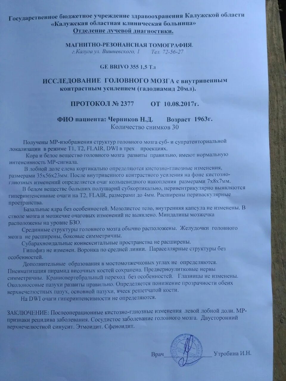 Кистозно глиозные изменения в лобной доле. Опухоль головного мозга заключение. заключение астроцитома. глиозные изменения мозжечка.