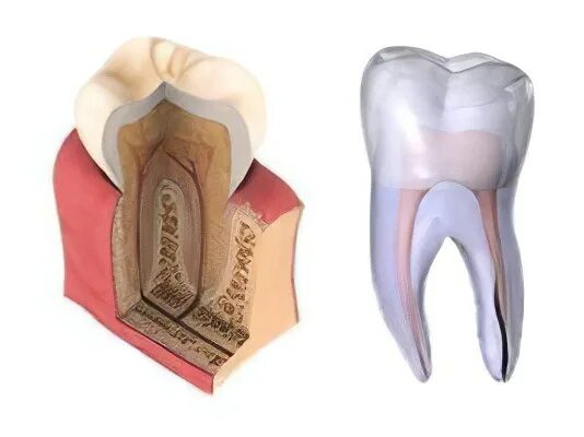 Некроз зуба как выглядит Pin on Demonstration Dental, Dental world, Dental problems