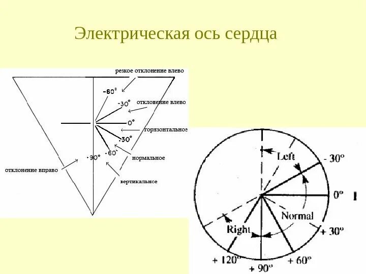 Что значит ось сердца горизонтальная. Что значит ось сердца горизонтальная
