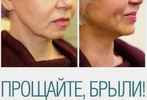 Брылы