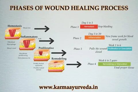 Wound healing