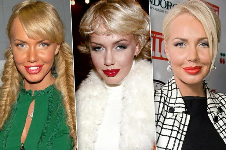 Маша малиновская до и после операции. Малиновская маша до и после пластики 2021. Маша малиновская до пластики. Малиновская до и после пластики. Маша малиновская в молодости.