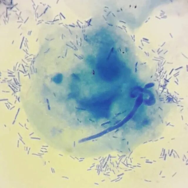 Candida albicans псевдомицелий. мицелий и псевдомицелий в мазке. лептотрикс микроскопия. микрофилярии у собак мазок. морфология палочек дедерлейна.