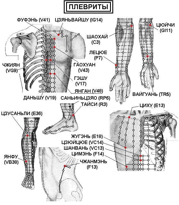 Точка простаты. Точки акупунктуры при воспалении легких. Эледиа акупунктура атлас. Точки акупунктуры при пневмонии. Точки акупунктуры при боли в пояснице.