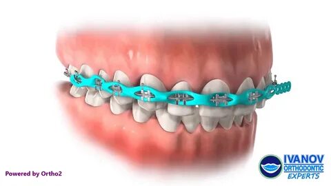 Chain power