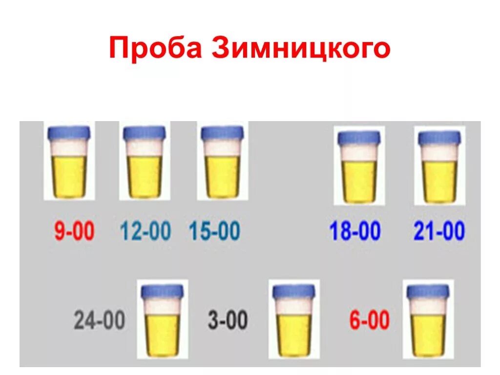 Проба зимницкий анализ. Проба Зимницкого диурез. Исследование мочи проба по Зимницкому. Проба мочи по Зимницкому подготовка. Проба мочи по Зимницкому методика исследования.