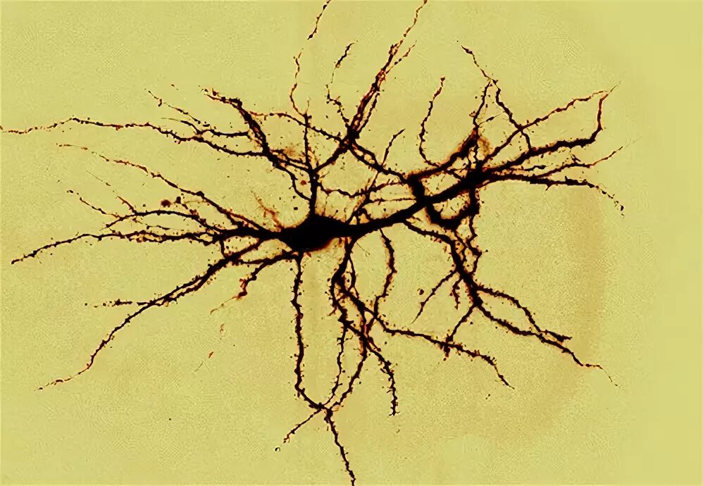 Короткие аксоны сильно ветвятся. Шипиковый аппарат дендритов. Дендриты зарисовка. Neuron Axon dendrite. Дендрит фото анатомия на прозрачном фоне.