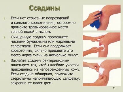Получили незначительные повреждения