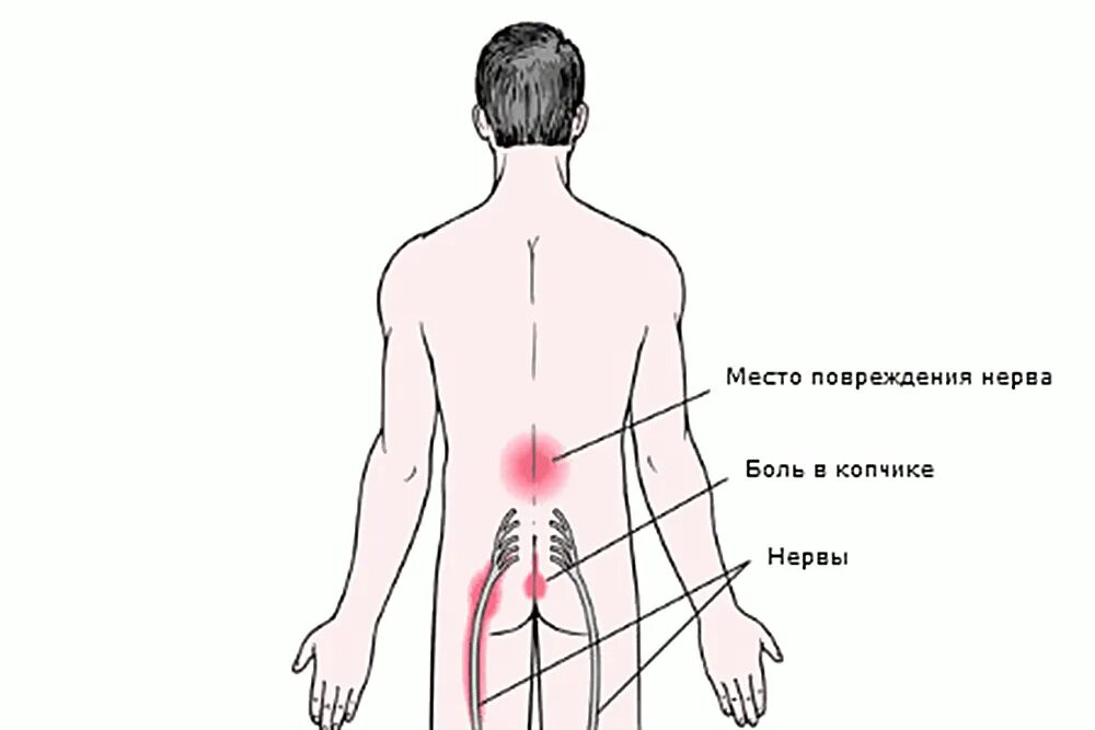 Боль под правой лопаткой. Боль в позвоночнике. Болит спина и шея. Миозит трапециевидной мышцы. Шея со спины.