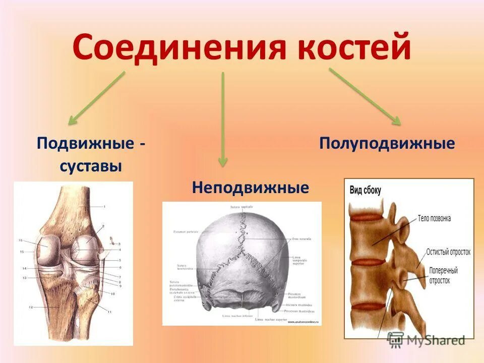 Соединение костей шов кости. Неподвижные полуподвижные и подвижные соединения костей. Типы соединения костей полуподвижные. Полуподвижное соединение костей рисунок. Типы соединения костей человека рисунок.