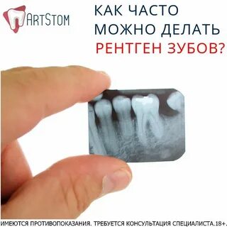 Рентген зуба фото