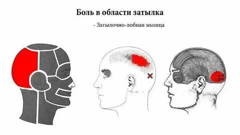 Головные боли с левой