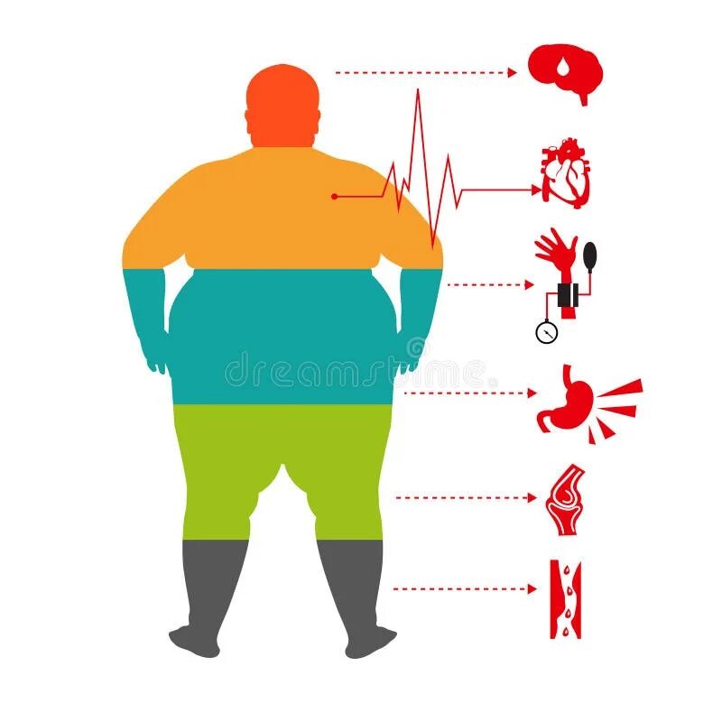 Obesity complications. Ожирение арты. Obesity epidemiology. Obesity and cardiovascular disease. Ожирение.