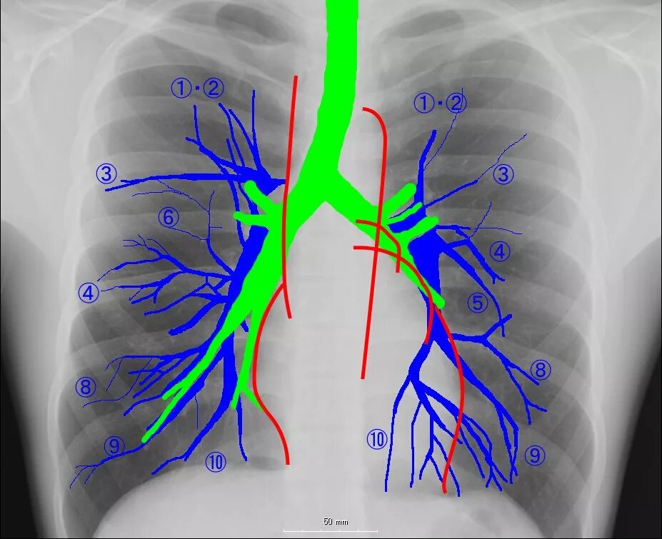 Ветви легочной артерии на кт анатомия. Легочные артерии анатомия. Сегменты легочной артерии. Сегментарное строение легочной артерии. Легкие артерии и вены