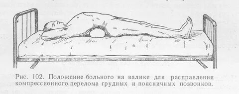 Можно сидеть при компрессионном переломе