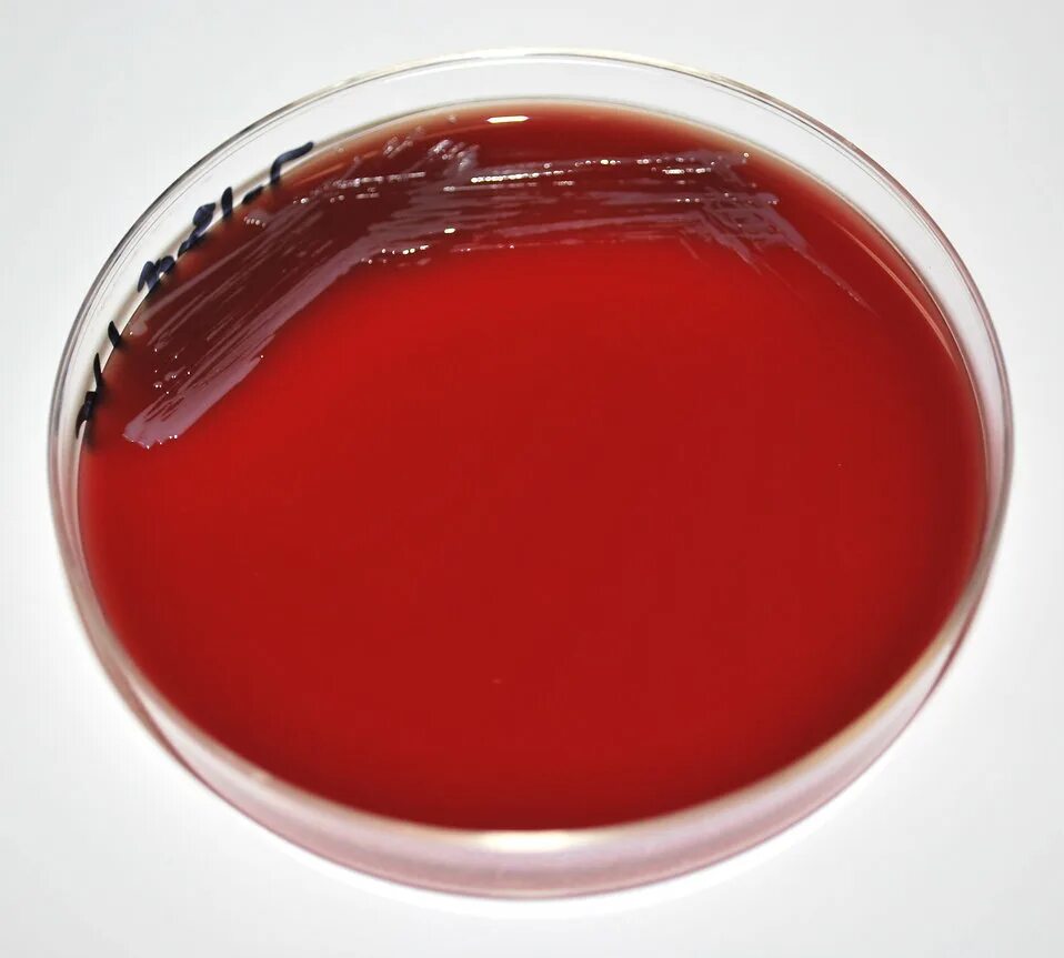 агар агар возбудитель