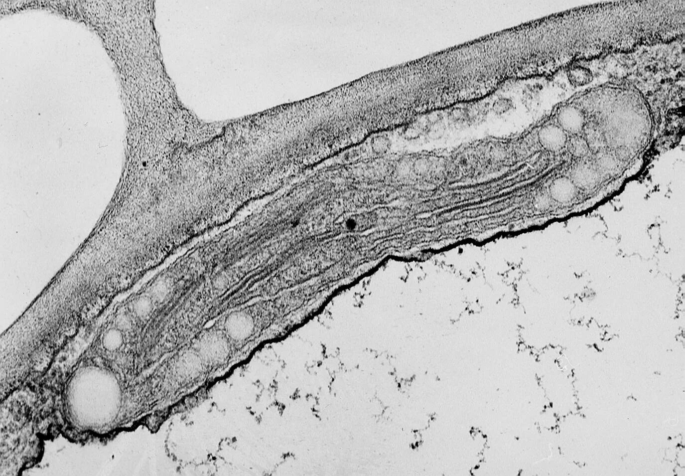 Хромопласты в клетке. Микрофотография хромопласта. Пластиды электронная микрофотография. Клетки мякоти томата под микроскопом. Хромопласты в клетках мякоти томата.