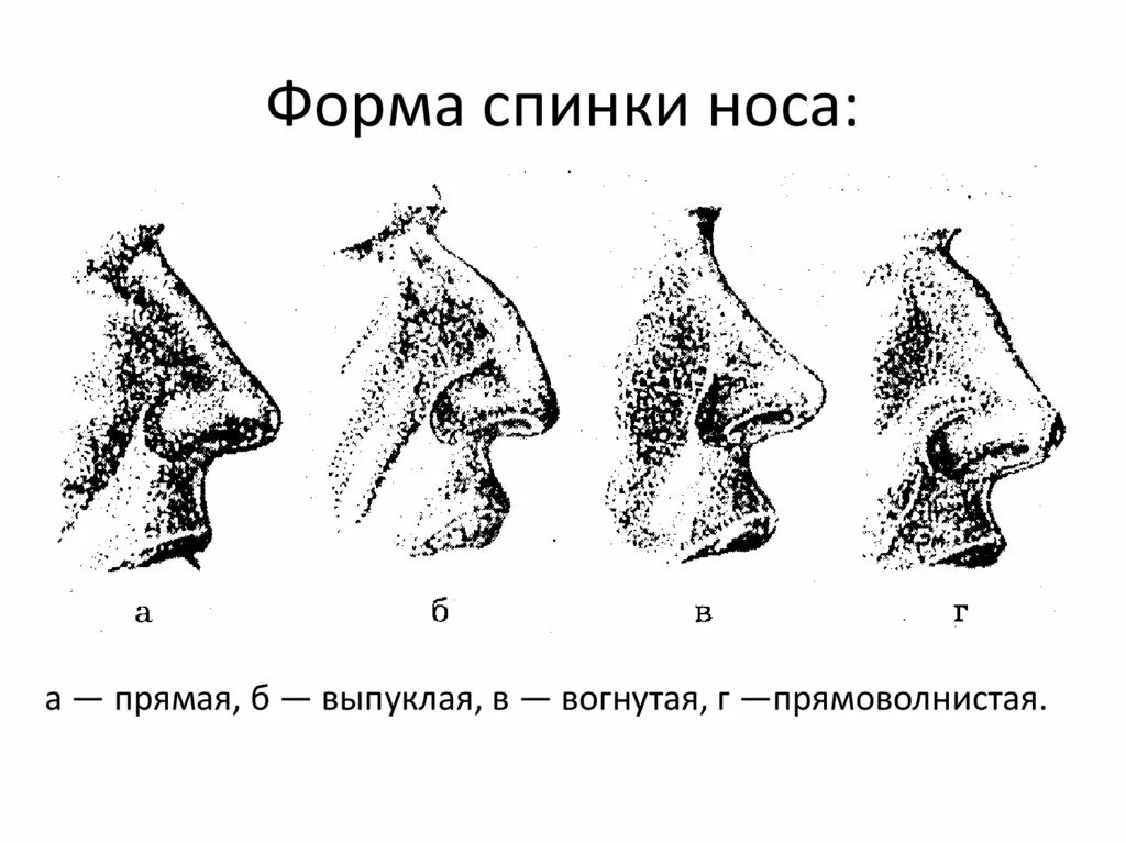 Какой размер носа. Контур спинки носа криминалистика. Форма кончика носа криминалистика. Выступание носа криминалистика. Ширина носа криминалистика.