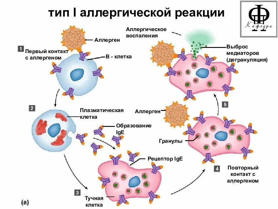 Аллерген контакты. Схема аллергической реакции 1 типа иммунология. Механизм развития аллергии 1 типа. Аллергическая реакция первого типа патогенез. Механизм развития аллергической реакции схема.