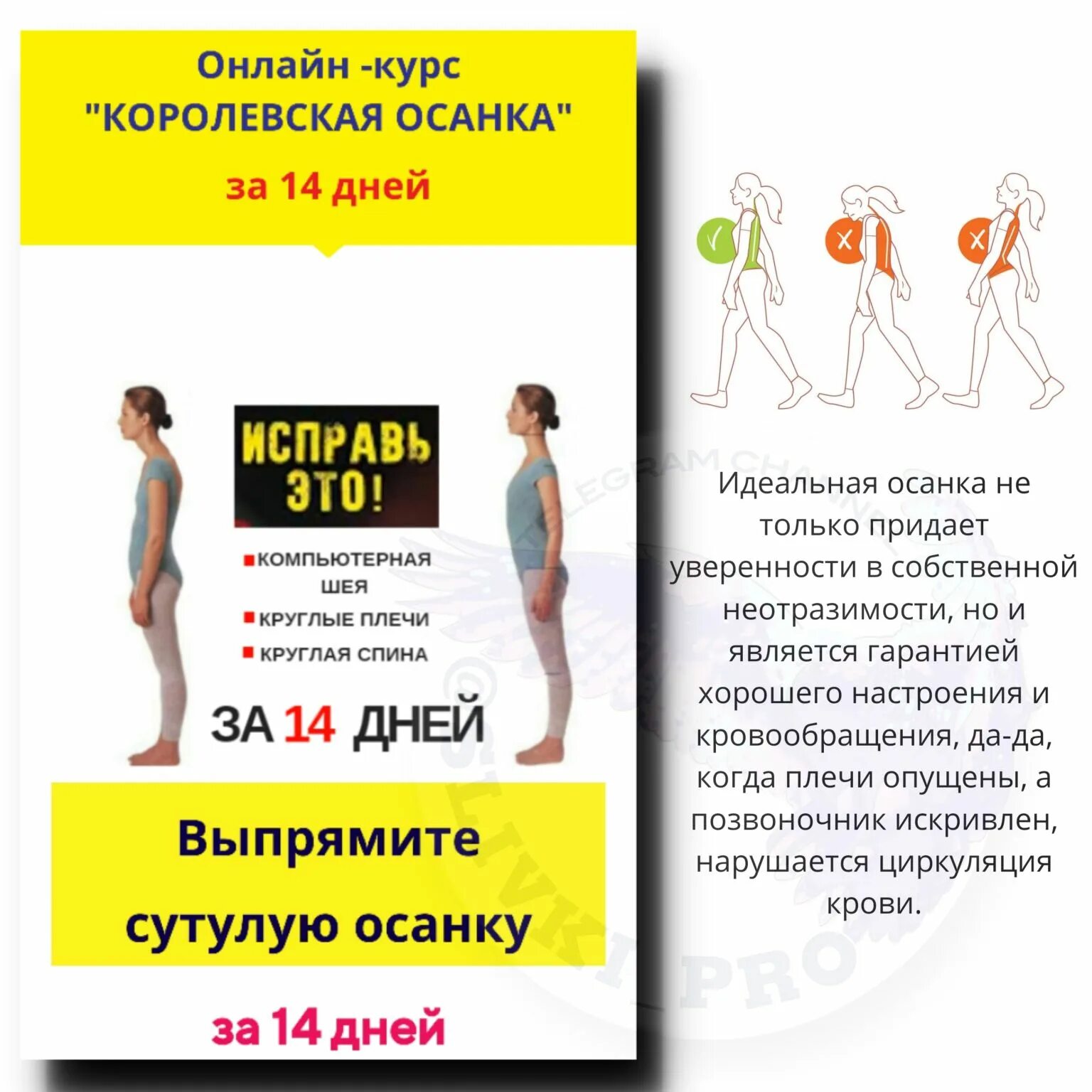 Как проверить осанку. Можно ли выпрямить осанку. Мышцы спины осанка сутулость. Упражнения для исправления осанки у взрослых в домашних. Правильная осанка.
