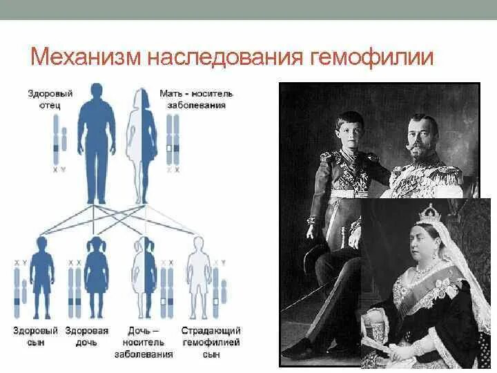 Гемофилия Тип наследования признака. Схема наследственности гемофилии. Механизм наследования гемофилии. Схема наследования гемофилии у человека. Гемофилия 7