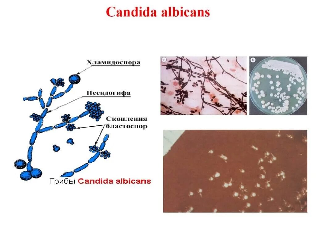 Грибы рода кандида альбиканс. Дрожжеподобные грибы рода кандида. Грибы рода Candida микробиология. Грибы аспергилл кандида. На коже обнаружены споры