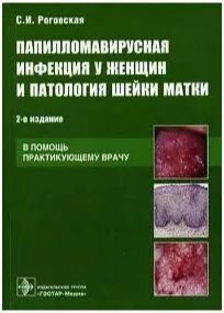 Папилломавирусная инфекция шейки