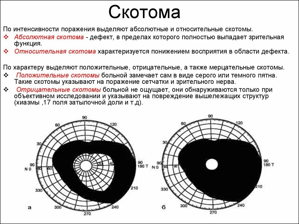 Периметрия скотомы. Скотома Бьеррума. Центральная скотома периметрия. Скотома Зейделя. Почему при боковом зрении хорошо видна