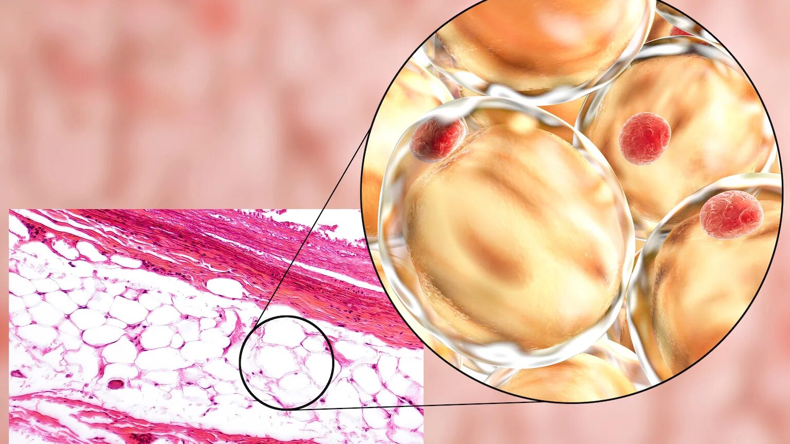 Жировые клетки адипоциты. Адипоциты гистология. Адипоциты микроскопия. Жировая соединительная ткань.