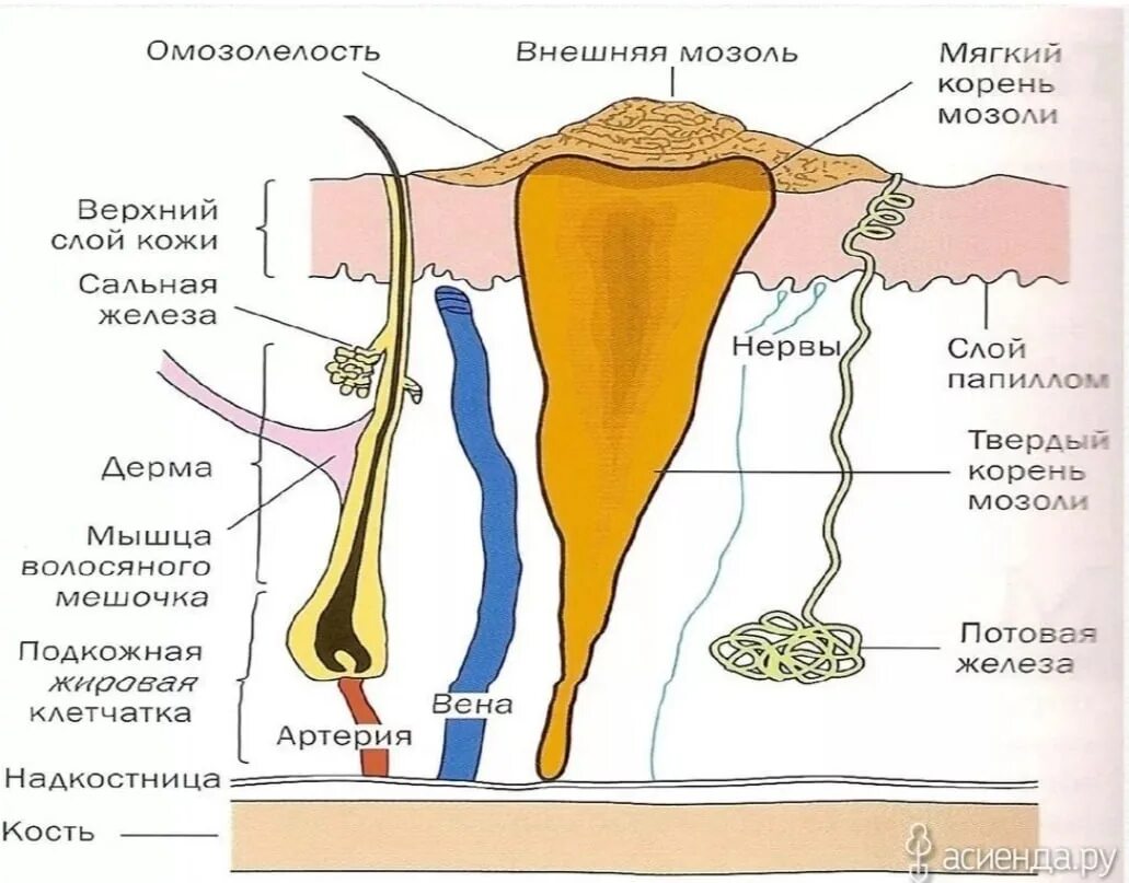 Почему образуются внутренние. Стержневая корневая мозоль. Стержневая мозоль внутри строение. Стержневая мозоль на стопе.