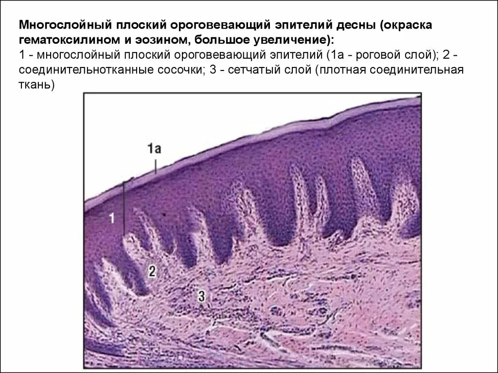 Плоский эпителий гистология. Строение десны гистология. Эпителий десны гистология многослойный плоский ороговевающий. Эпителий десны гистология строение. Альвеолярная десна