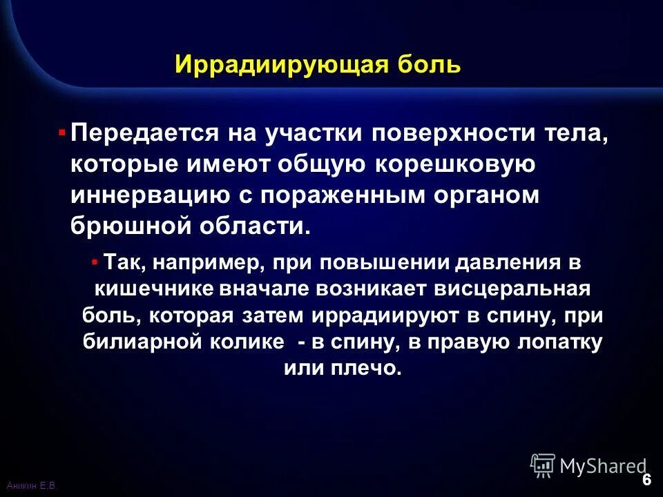 Иррадиация поясницы