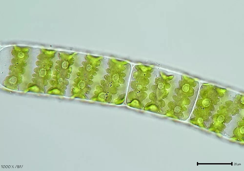Пигменты фотосинтеза в хроматофоре. Спирогира водоросль. Хроматофоры водорослей улотрикс. Зеленые водоросли улотрикс. Хлоропласт спирогиры.