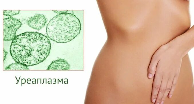 Передается ли уреаплазма от женщины. Передается ли уреаплазма от женщины