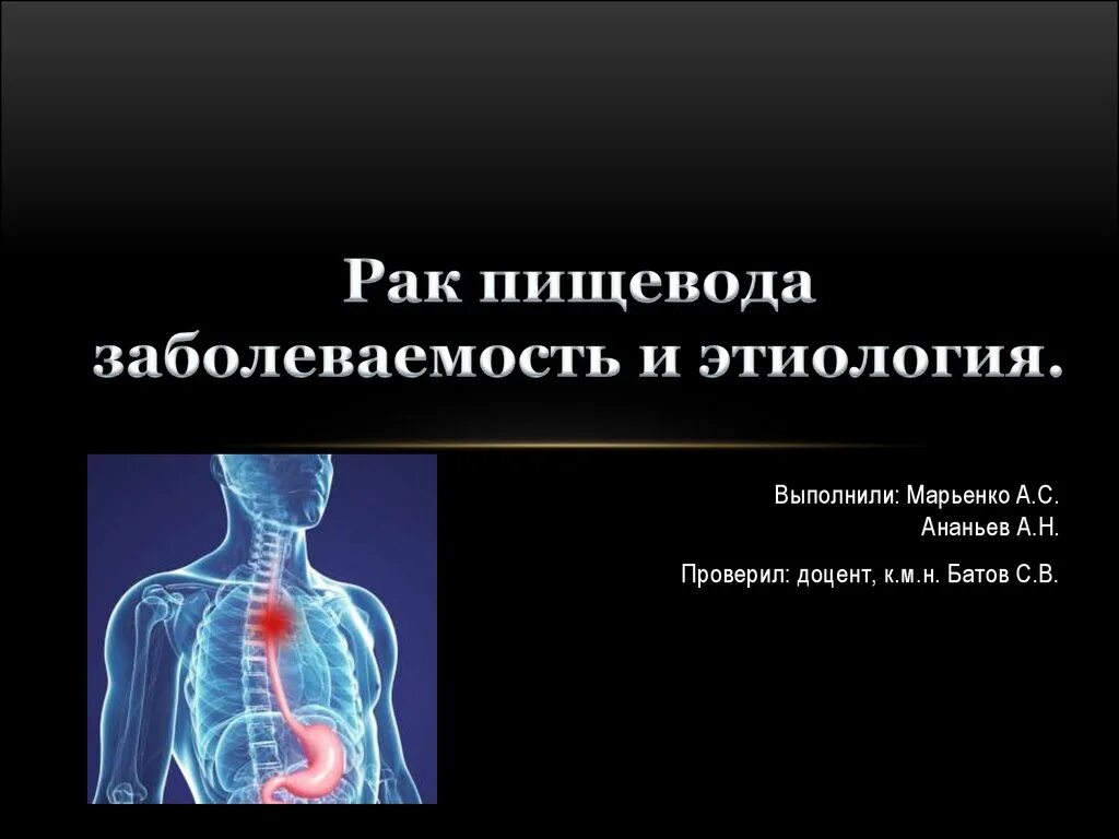 Опухоли пищевода презентация хирургия. Онкология презентация. Презентация на тему онкология. Фото заболеваемости пищевода. Презентация пищевода