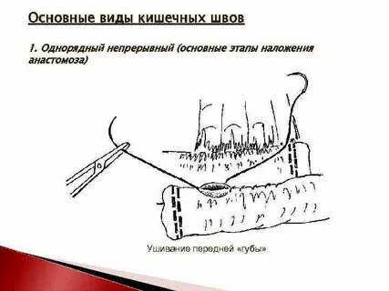 Кишечные швы топографическая анатомия