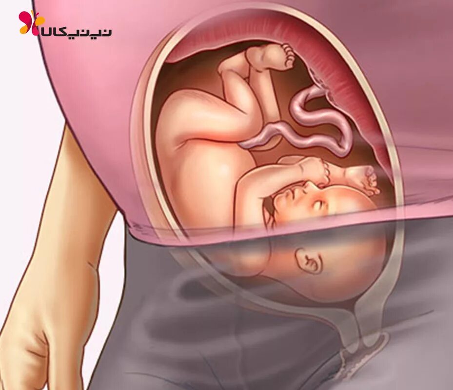 Расположение ребенка на 36 неделе. Расположение малыша в животе. 36 недель икает
