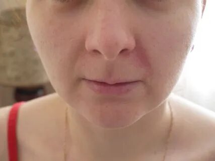 Полоски на щеках