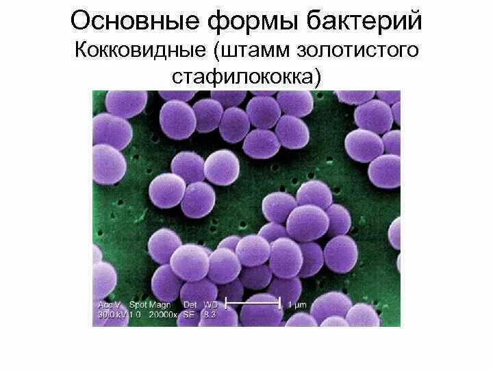 Последовательность этапов создания нового штамма бактерий. Штаммы золотистого стафилококка. Штамм бактерий. Штаммы стафилококков. Виды штаммов микроорганизмов.