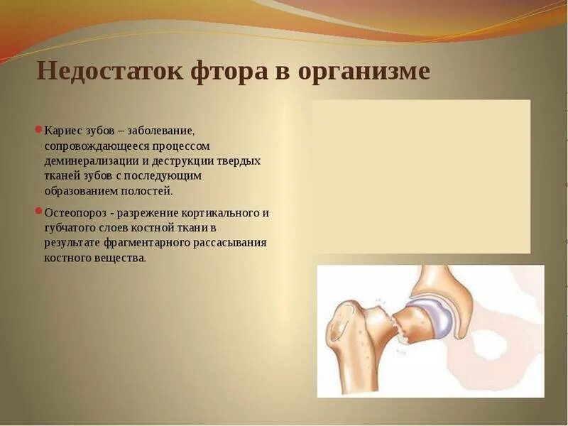 Недостаток фтора может привести к развитию чего. Недостаток фтора может привести к развитию чего