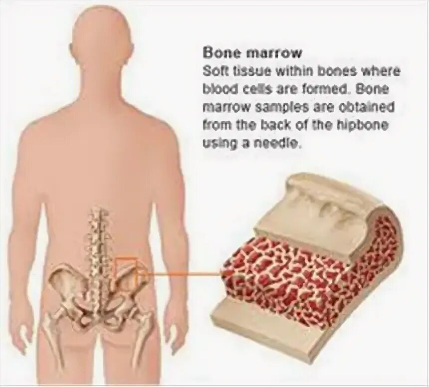 Трансплантация костного мозга. Костный мозг где находится. Костный мозг в позвоночном. Что будет если есть костный мозг