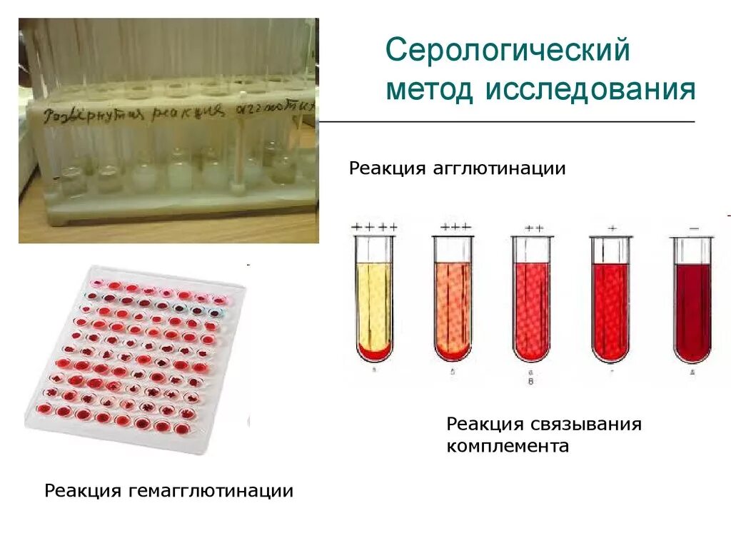 Серологические исследования что это. Серологический метод (ИФА, РСК, РТГА). Реакция агглютинации это серологическая реакция. Сыворотка крови для серологического исследования. Серологическая реакция агглютинации микробиология.